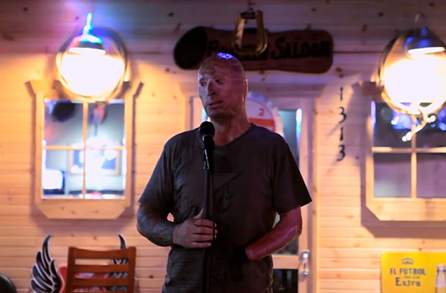 Bobby Henline stand-up comedian